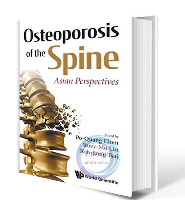 دانلود کتابOsteoporosis of the Spine: Asian Perspectives2021 (ORIGINAL PDF)